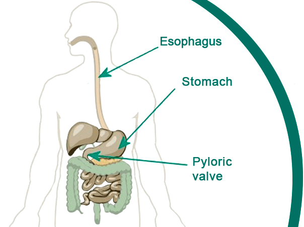 infographic for gastroparesis and vagus nerve explanation